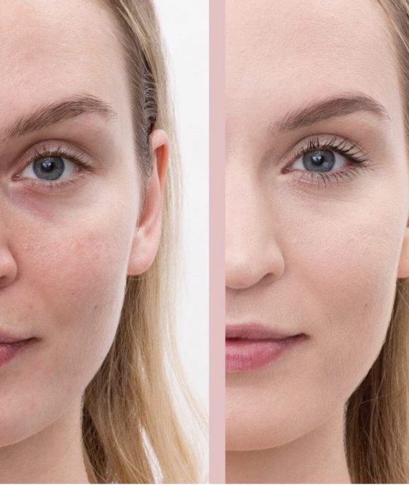 Cover acne with makeup با آرایش آکنه را بپوشانید