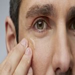 ژل ضد خستگی دور چشم آقایان کلینیک