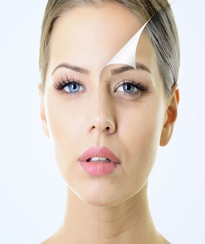 اسید گلیکولیک لایه بردار پوست