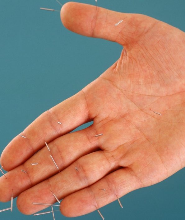 Acupuncture terms3 اصطلاحات طب سوزنی