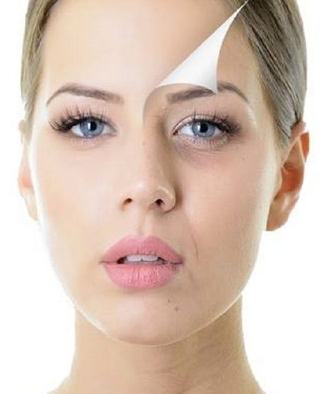 همه چیز در مورد لایه بردارهای شیمیایی