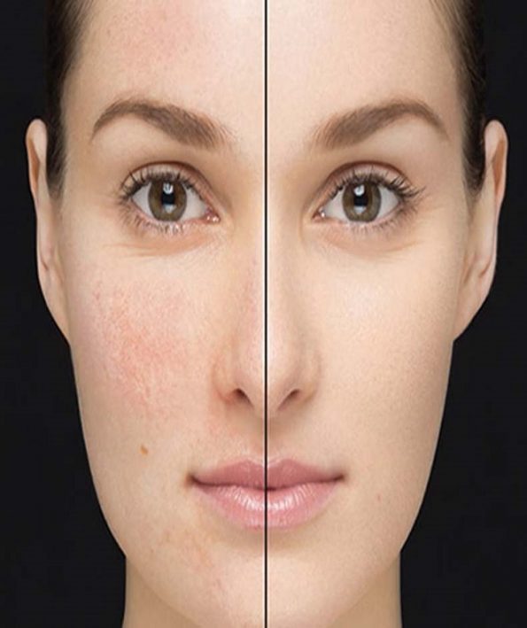 Choosing the right makeup primer 11111 انتخاب پرایمر آرایشی مناسب