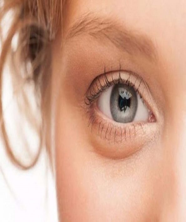 In us puffy eyes 2222 در مان پف چشم
