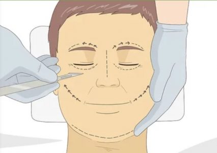 چگونه پوست صورت خود را لیفت کنیم؟