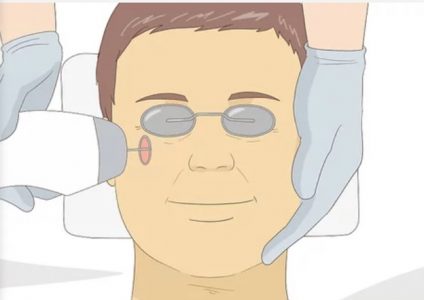چگونه پوست صورت خود را لیفت کنیم؟
