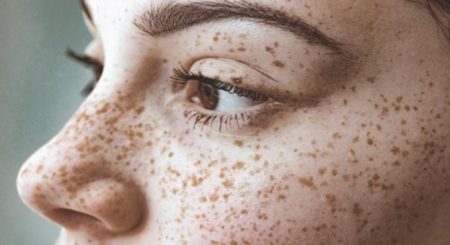 شناسایی و درک بهتر پوست خود