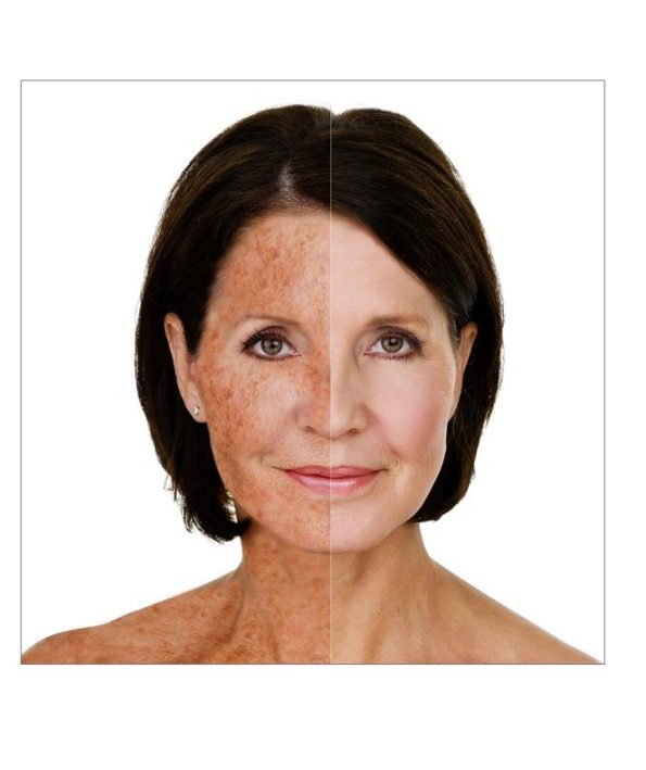 All-about-UV-damage 3 همه چیز راجع به صدمات ناشی از اشعه UV