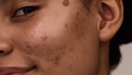 همه چیز راجع به روتین مراقبت از پوست حساس