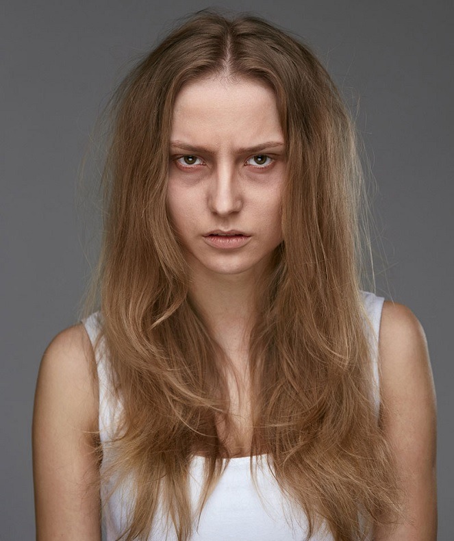 استرس چه تاثیری روی پوست می گذارد؟