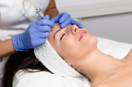 شرایط استفاده از میکرودرم ابریژن بعد از اسید سالیسیلیک