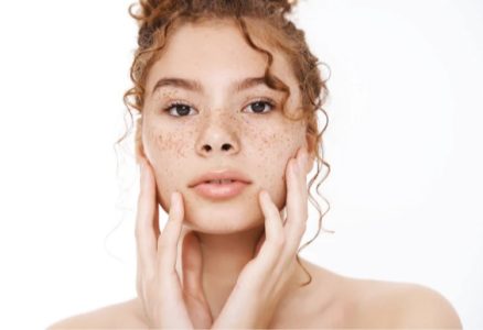 استفاده کردن از اسید آزلائیک بعد از لایه برداری AHA