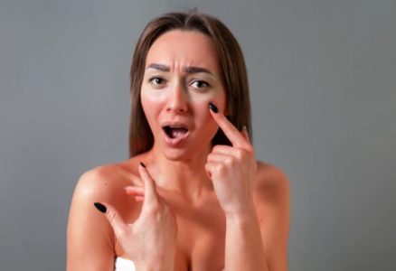 استفاده کردن از اسید آزلائیک برای آفتاب سوختگی
