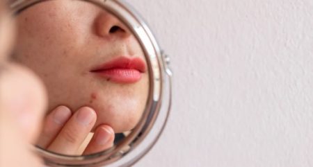 ترفندهای زیبایی با استفاده از پوست موز 