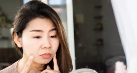 چگونه می توان از شر خطوط ماریونت لب خلاص شد؟