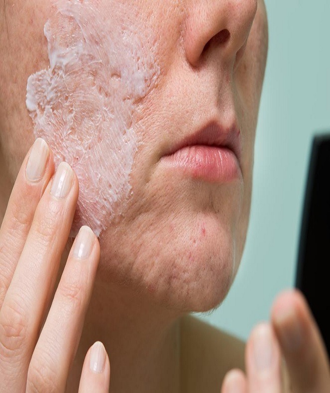 آیا اسید سالسیلیک برای جوش ها مفید است؟