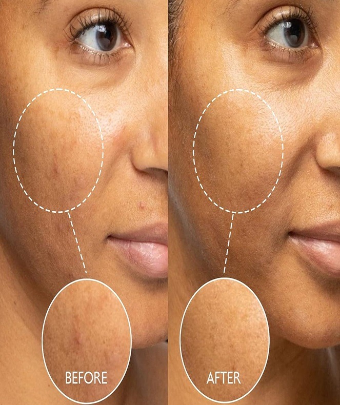 caudalie vitamin c serum