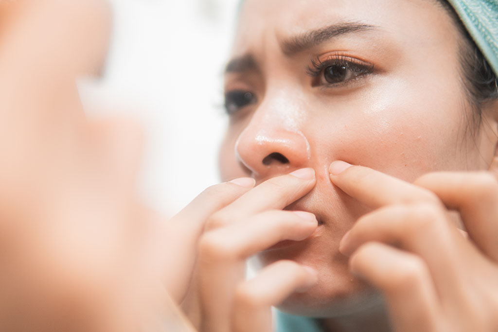 asian woman squeezing pimple on the cheek to the mirror